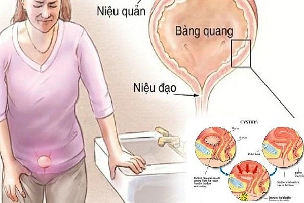 6 cách cai nghiện thủ dâm hiệu quả từ bác sĩ bạn nên biết