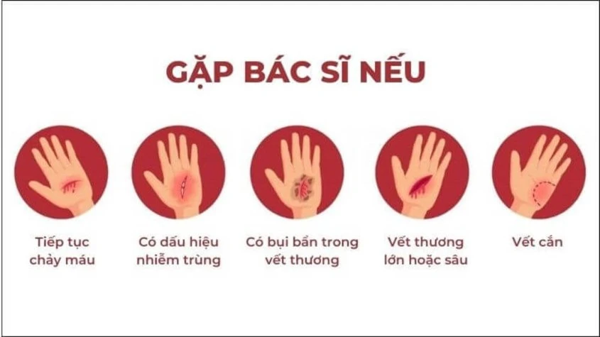 Cách xử lý vết thương té xe trầy chân nữ an toàn và đúng cách