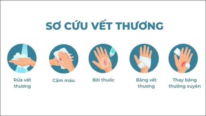 Cách xử lý vết thương té xe trầy chân nữ an toàn và đúng cách